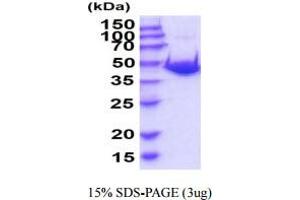 Adenosylhomocysteinase (AHCY) (AA 1-432) protein (His tag)