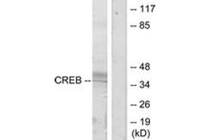 Western blot analysis of extracts from HeLa cells, treated with UV, using CREB (Ab-133) Antibody. (CREB1 抗体  (AA 100-149))