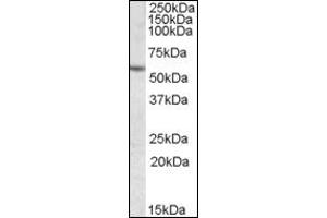 Image no. 2 for anti-Carboxylesterase 1 (CES1) (Internal Region) antibody (ABIN372769) (CES1 抗体  (Internal Region))