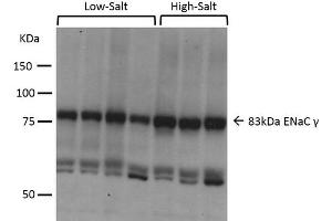 Western blot analysis of Mouse kidney cortex showing detection of ENaC protein using Rabbit Anti-ENaC Polyclonal Antibody . (SCNN1A 抗体  (AA 629-650) (APC))