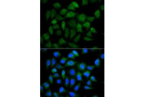 Immunofluorescence analysis of HeLa cells using AFP antibody.