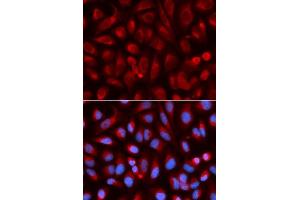 Immunofluorescence analysis of U2OS cell using ADA antibody. (ADA 抗体  (AA 1-363))