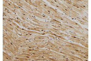 ABIN6269012 at 1/100 staining Rat heart tissue by IHC-P. (HSP70 1A 抗体  (C-Term))