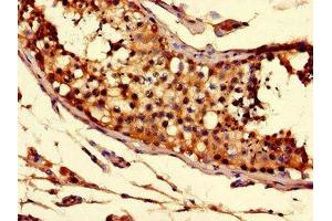 Immunohistochemistry of paraffin-embedded human testis tissue using ABIN7170279 at dilution of 1:100 (Solute Carrier Family 52 (Riboflavin Transporter), Member 3 (SLC52A3) (AA 159-220) 抗体)