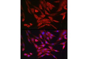 Immunofluorescence analysis of NIH/3T3 cells using MRPL28 Rabbit mAb (ABIN7268566) at dilution of 1:100 (40x lens). (MRPL28 抗体)