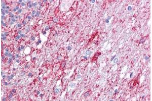 Anti-ATG9A antibody IHC staining of human brain, cerebellum. (ATG9A 抗体  (C-Term))