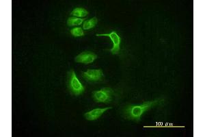 Immunofluorescence of monoclonal antibody to EIF2C2 on HeLa cell. (AGO2 抗体  (AA 1-377))