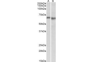 AP21300PU-N AMPK2 antibody staining of Mouse (A) and Rat (B) Heart lysate at 0. (PRKAA2 抗体  (Internal Region))