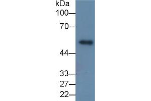 Detection of MMP8 in Porcine Skin lysate using Monoclonal Antibody to Matrix Metalloproteinase 8 (MMP8) (MMP8 抗体  (AA 101-467))