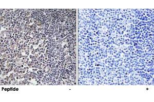 Immunohistochemistry analysis of paraffin-embedded human tonsil tissue using MRPS16 polyclonal antibody . (MRPS16 抗体)