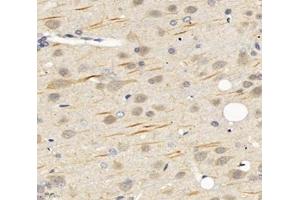 Immunohistochemistry (Paraffin-embedded Sections) (IHC (p)) image for anti-Sodium Channel, Voltage-Gated, Type VIII, alpha (SCN8A) antibody (ABIN7075647)