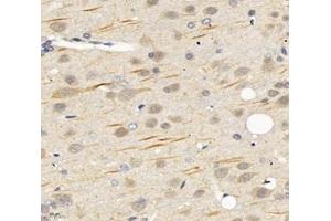 Immunohistochemistry analysis of paraffin-embedded rat brain using,SCN8A (ABIN7075647) at dilution of 1: 1200 (SCN8A 抗体)