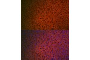 Immunofluorescence analysis of rat liver cells using Factor IX / F9 Rabbit pAb (ABIN3022173, ABIN3022174, ABIN3022175, ABIN1512886 and ABIN6218646) at dilution of 1:100 (40x lens). (Coagulation Factor IX 抗体  (AA 29-192))