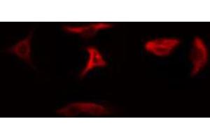 ABIN6274783 staining Hela cells by IF/ICC. (RPL5 抗体  (C-Term))