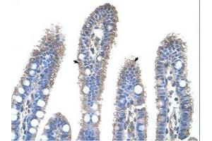 Image no. 1 for anti-Ornithine Carbamoyltransferase (OTC) (N-Term) antibody (ABIN203390) (OTC 抗体  (N-Term))