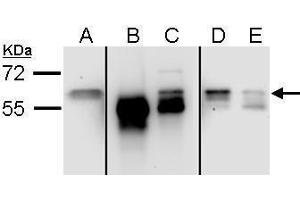 IP Image Sample (ug of whole cell lysate) A: 293 (input) B: control rabbit IgG-IP C: Stau1-IP , D: Post-IP lysate from control rabbit IgG-IP E:Post-IP lysate from Stau1-IP 7. (STAU1/Staufen 抗体  (C-Term))