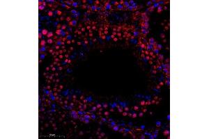 Immunofluorescence (Paraffin-embedded Sections) (IF (p)) image for anti-Ribosomal Protein L10L (RPL10L) antibody (ABIN7075429)
