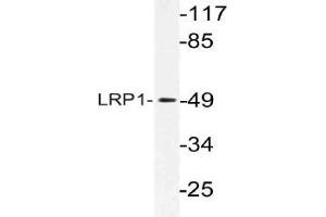 Western blot (WB) analysis of LRP1 antibody in extracts from HepG2 cells. (LRP1 抗体)