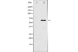 Western blot analysis of p62 Dok expression in K562 whole cell lysates,The lane on the left is treated with the antigen-specific peptide. (DOK1 抗体  (Internal Region))