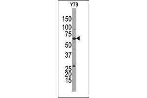 Western blot analysis of anti-GUCY1B3 Pab((ABIN392806 and ABIN2842242)) in Y79 cell line lysate. (GUCY1B3 抗体  (AA 589-619))