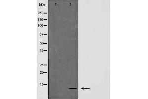 Western blot analysis of NDUFA4 expression in HepG2 cells,The lane on the left is treated with the antigen-specific peptide. (NDUFA4 抗体  (C-Term))