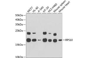 Western blot analysis of extracts of various cell lines, using RPS10 antibody (ABIN6132945, ABIN6147192, ABIN6147194 and ABIN6221686) at 1:1000 dilution. (RPS10 抗体  (AA 1-165))