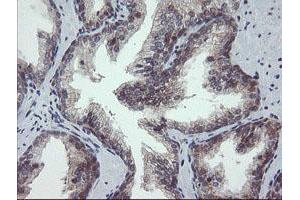 Image no. 1 for anti-Golgin, RAB6-Interacting (GORAB) (AA 35-394) antibody (ABIN1491441) (GORAB 抗体  (AA 35-394))