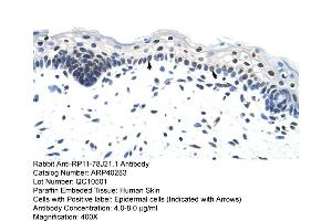 Rabbit Anti-RP11-78J21. (HNRNPA1L2 抗体  (N-Term))