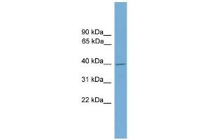 WB Suggested Anti-FBXO31 Antibody Titration: 0. (FBXO31 抗体  (Middle Region))