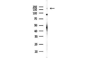 Western blot analysis of lysates from K562 cells, using Abca6 Antibody at 1/1000 dilution.