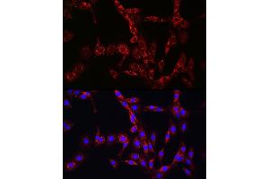 Immunofluorescence analysis of PC-12 cells using [KO Validated] Hexokinase II Rabbit pAb (ABIN3021255, ABIN3021256, ABIN3021257 and ABIN6214088) at dilution of 1:100 (40x lens).