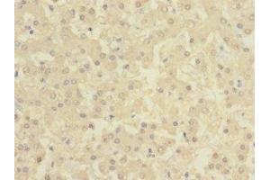 Immunohistochemistry of paraffin-embedded human liver tissue using ABIN7145876 at dilution of 1:100 (BTN1A1 抗体  (AA 27-210))