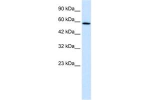 Western Blotting (WB) image for anti-TBC1 Domain Family, Member 10B (TBC1D10B) antibody (ABIN2460976) (TBC1D10B 抗体)