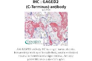 Image no. 1 for anti-X Antigen Family, Member 1B (XAGE1B) (C-Term) antibody (ABIN1734558) (XAGE1B/GAGED2 抗体  (C-Term))