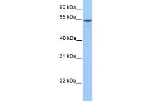 WB Suggested Anti-KIAA1958 Antibody Titration: 0. (KIAA1958 抗体  (C-Term))