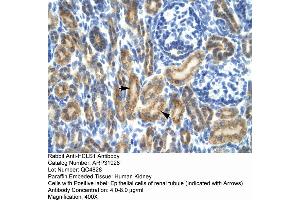 Rabbit Anti-HCLS1 Antibody  Paraffin Embedded Tissue: Human Kidney Cellular Data: Epithelial cells of renal tubule Antibody Concentration: 4. (HCLS1 抗体  (N-Term))