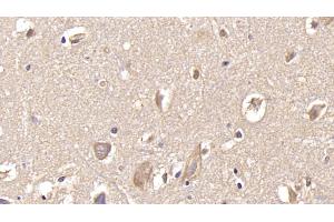 Detection of GRIA2 in Human Cerebrum Tissue using Monoclonal Antibody to Glutamate Receptor, Ionotropic, AMPA 2 (GRIA2) (GRIA2 抗体  (AA 413-527))