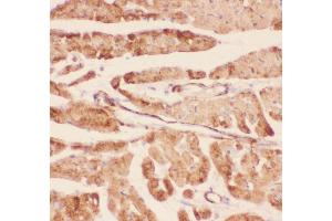 Anti-Desmin Picoband antibody,  IHC(P): Rat Cardiac Muscle Tissue (Desmin 抗体  (AA 1-304))