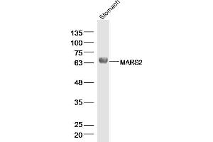 Rat stomach lysates probed with MARS2 Polyclonal Antibody, Unconjugated  at 1:300 dilution and 4˚C overnight incubation. (MARS2 抗体  (AA 31-130))