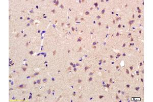 Formalin-fixed and paraffin embedded rat brain labeled with Rabbit Anti AKR1A1 Polyclonal Antibody, Unconjugated (ABIN872733) at 1:200 followed by conjugation to the secondary antibody and DAB staining (AKR1A1 抗体  (AA 53-130))