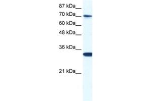 Western Blotting (WB) image for anti-CCR4-NOT Transcription Complex, Subunit 3 (CNOT3) antibody (ABIN2460917) (CNOT3 抗体)