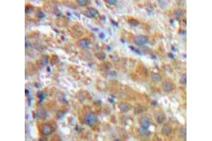 Used in DAB staining on fromalin fixed paraffin-embedded Liver tissue (SERPINA1 抗体  (AA 25-413))
