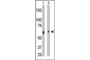 The anti-CERK Pab (ABIN391126 and ABIN2841252) is used in Western blot to detect CERK in mouse heart tissue lysate (Lane 1) and  cell lysate (Lane 2). (CERK 抗体  (C-Term))