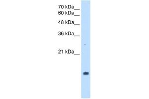 PPIA antibody used at 2. (PPIA 抗体)