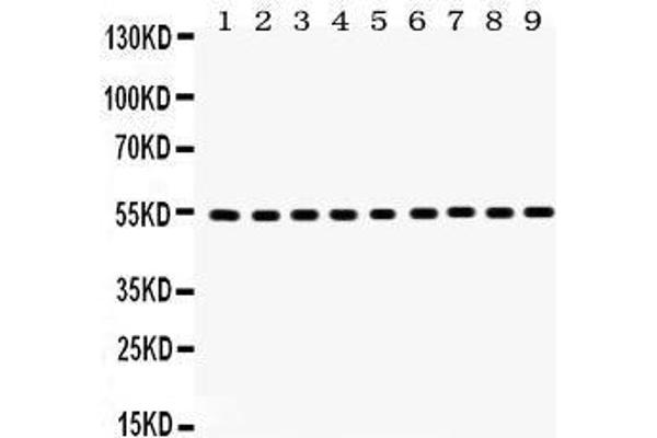 Vimentin 抗体  (C-Term)