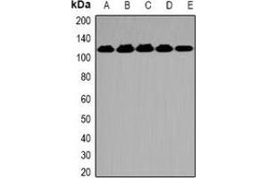 Western blot analysis of OGT expression in K562 (A), A549 (B), Hela (C), mouse spleen (D), mouse brain (E) whole cell lysates. (OGT 抗体)