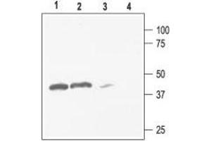 Western Blotting (WB) image for anti-Potassium Inwardly-Rectifying Channel, Subfamily J, Member 4 (KCNJ4) (AA 418-437), (Intracellular) antibody (ABIN7043485)