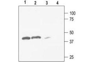 Western blot analysis of rat kidney (lanes 1 and 3) and brain (lanes 2 and 4) membranes: - 1,2. (KCNJ4 抗体  (C-Term, Intracellular))