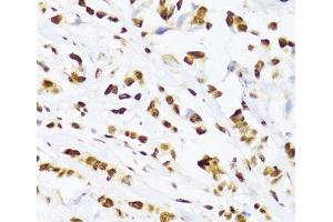 Immunohistochemistry (Paraffin-embedded Sections) (IHC (p)) image for anti-DEAD (Asp-Glu-Ala-Asp) Box Polypeptide 39B (DDX39B) antibody (ABIN7264385)