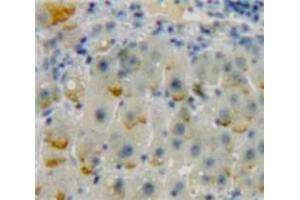 Used in DAB staining on fromalin fixed paraffin-embedded Liver tissue (ADCY9 抗体  (AA 1029-1282))